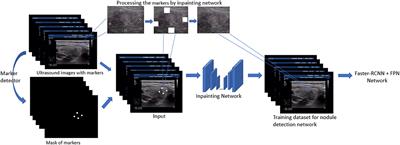 Texture Synthesis Based Thyroid Nodule Detection From Medical Ultrasound Images: Interpreting and Suppressing the Adversarial Effect of In-place Manual Annotation